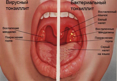 Косточки на ногах лечение в китае