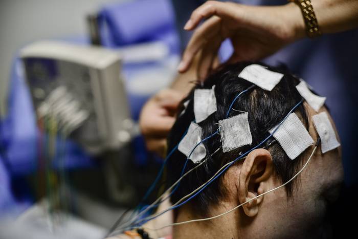 процесс прикрепления электродов для ЭЭГ