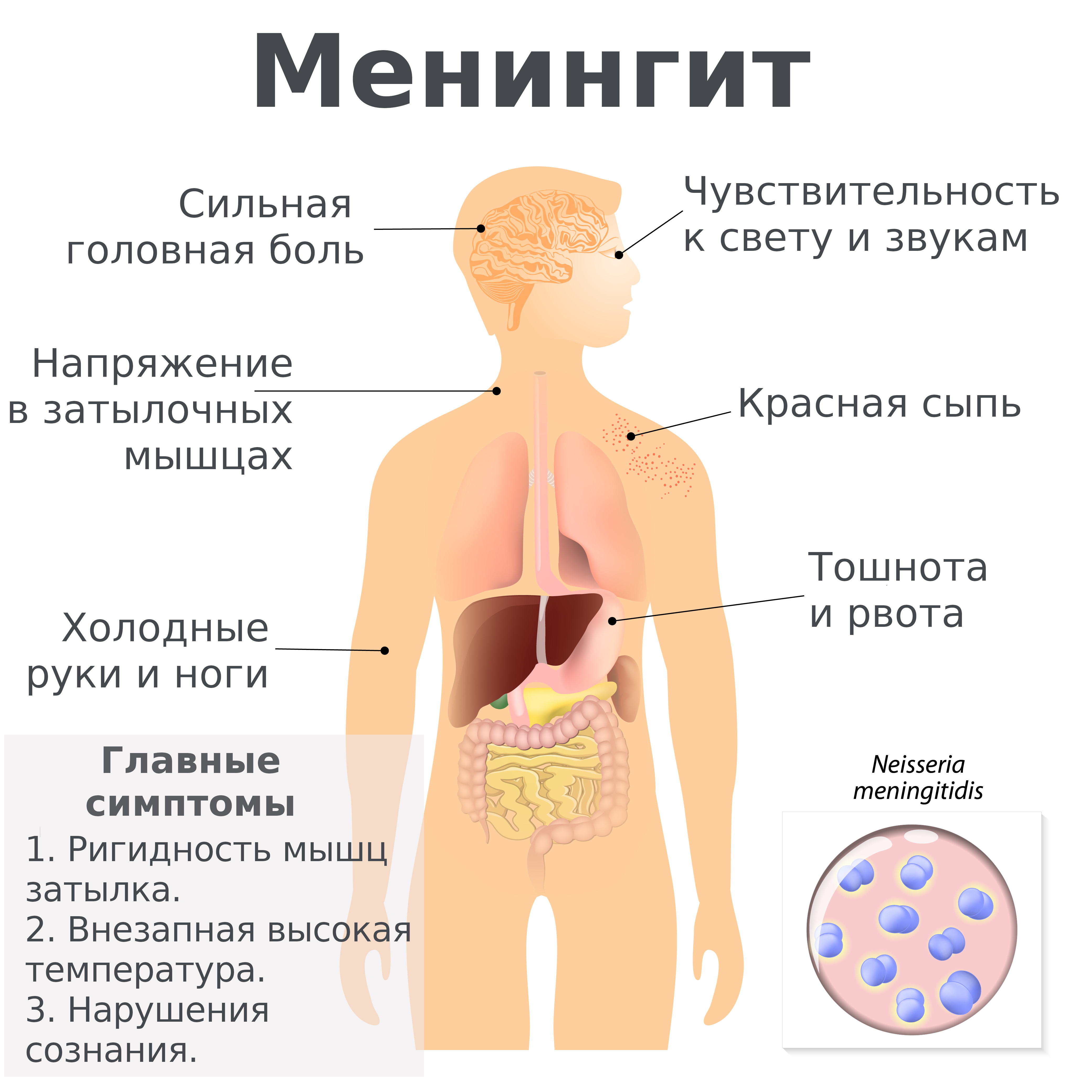 симптомы менингита